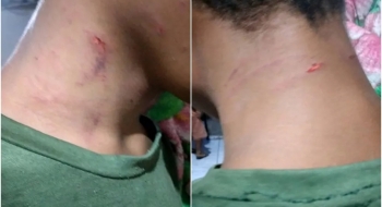 Mãe é suspeita de agredir, dopar e ameaçar filho com deficiência